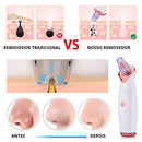 Removedor de Cravos e Espinhas - Pele Low